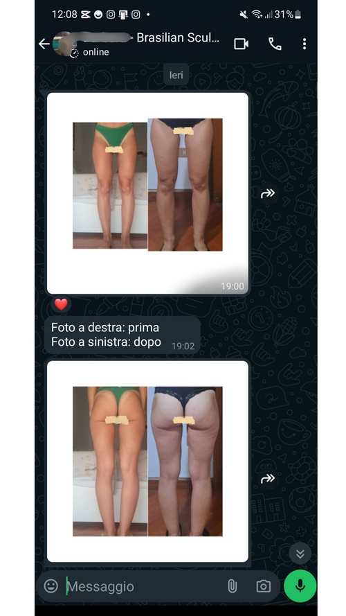 Prima e Dopo cliente reale
